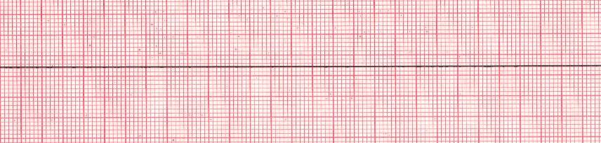 asystole.jpg