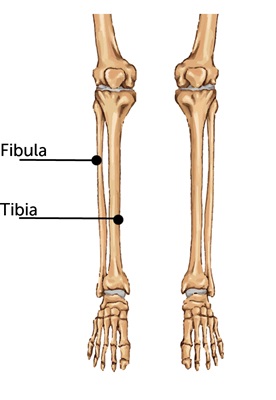 brokentibiafibula.ashx.jpeg