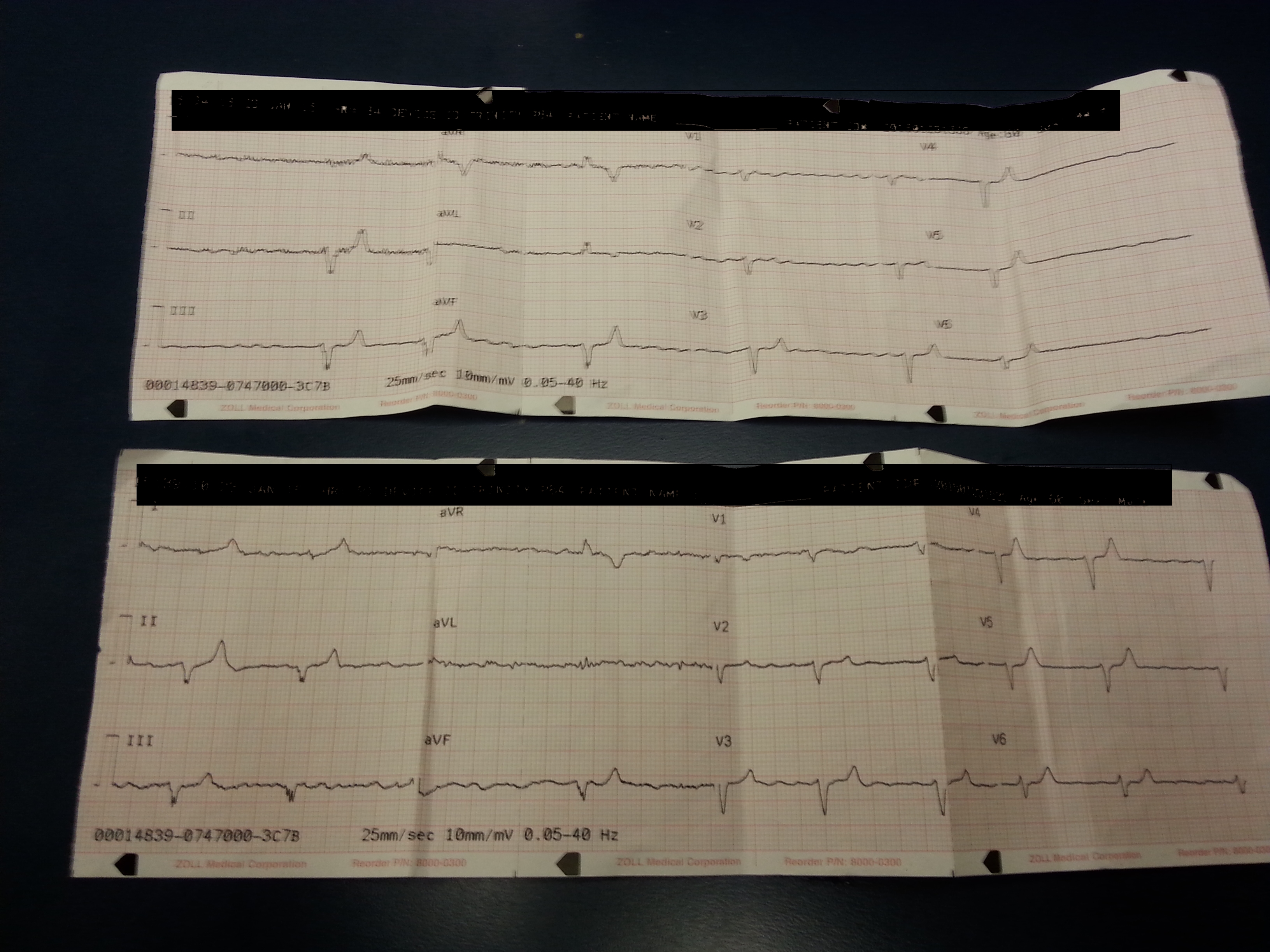 ekg.jpg