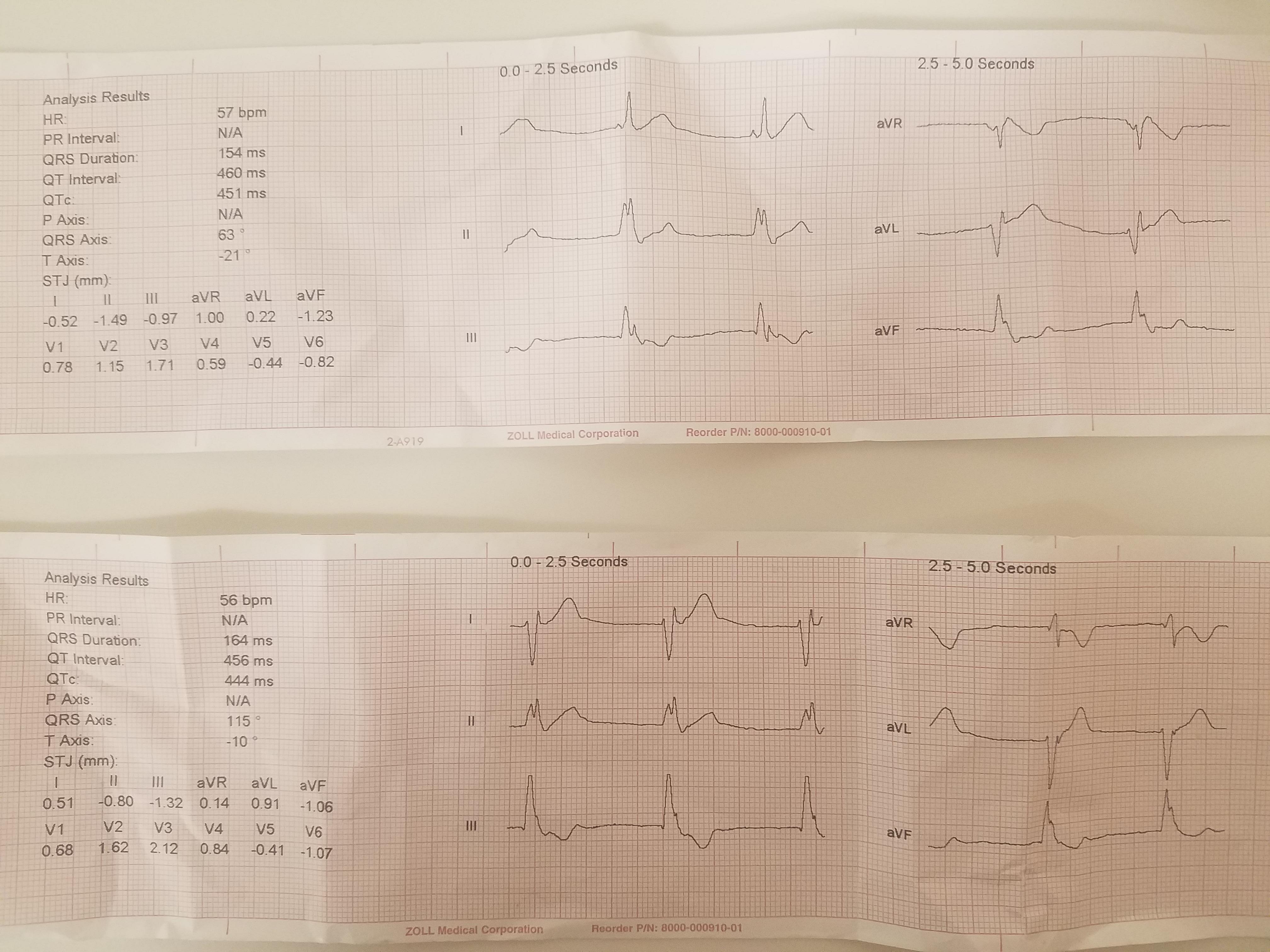 EKG1.jpg
