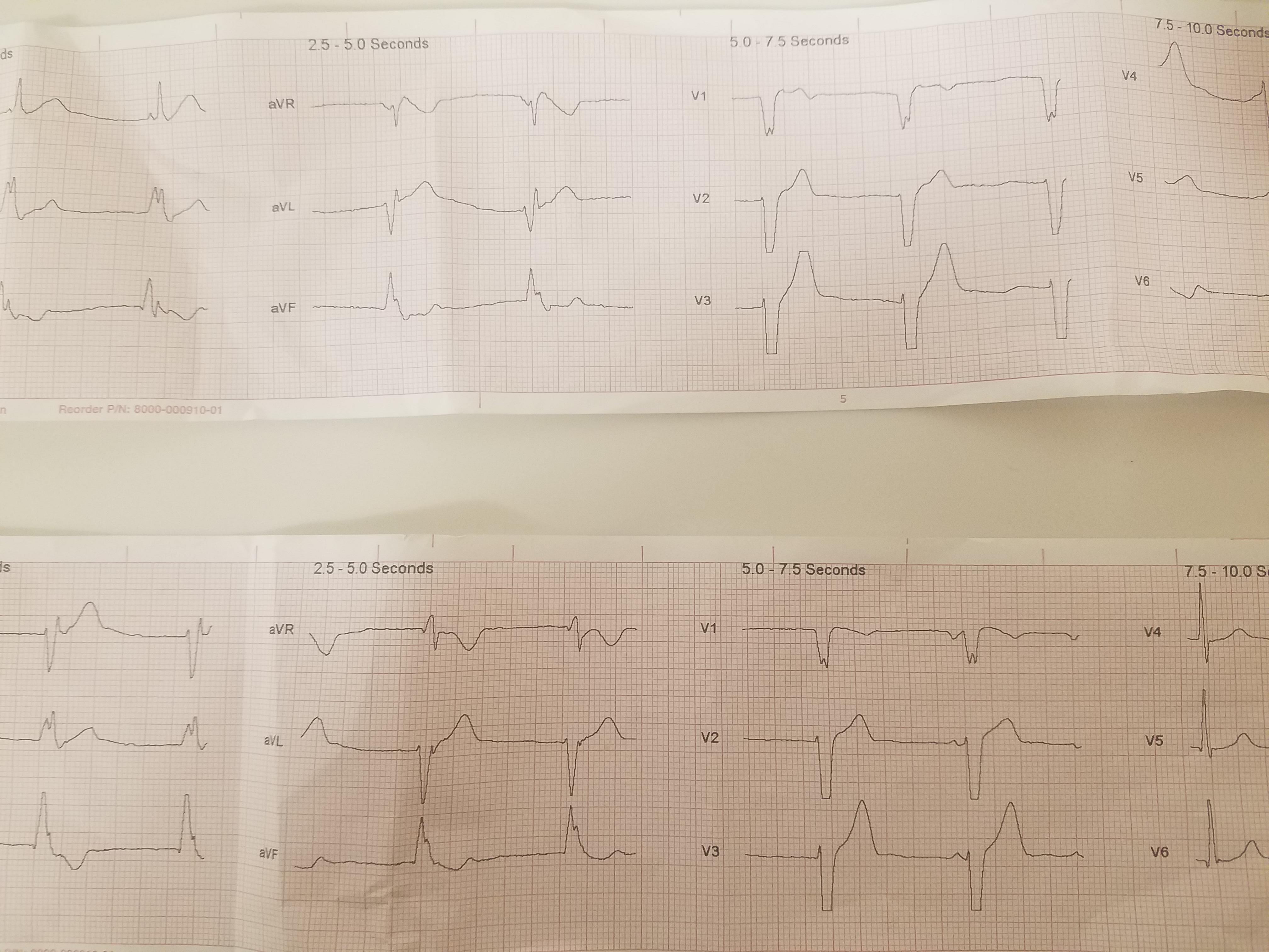 EKG2.jpg