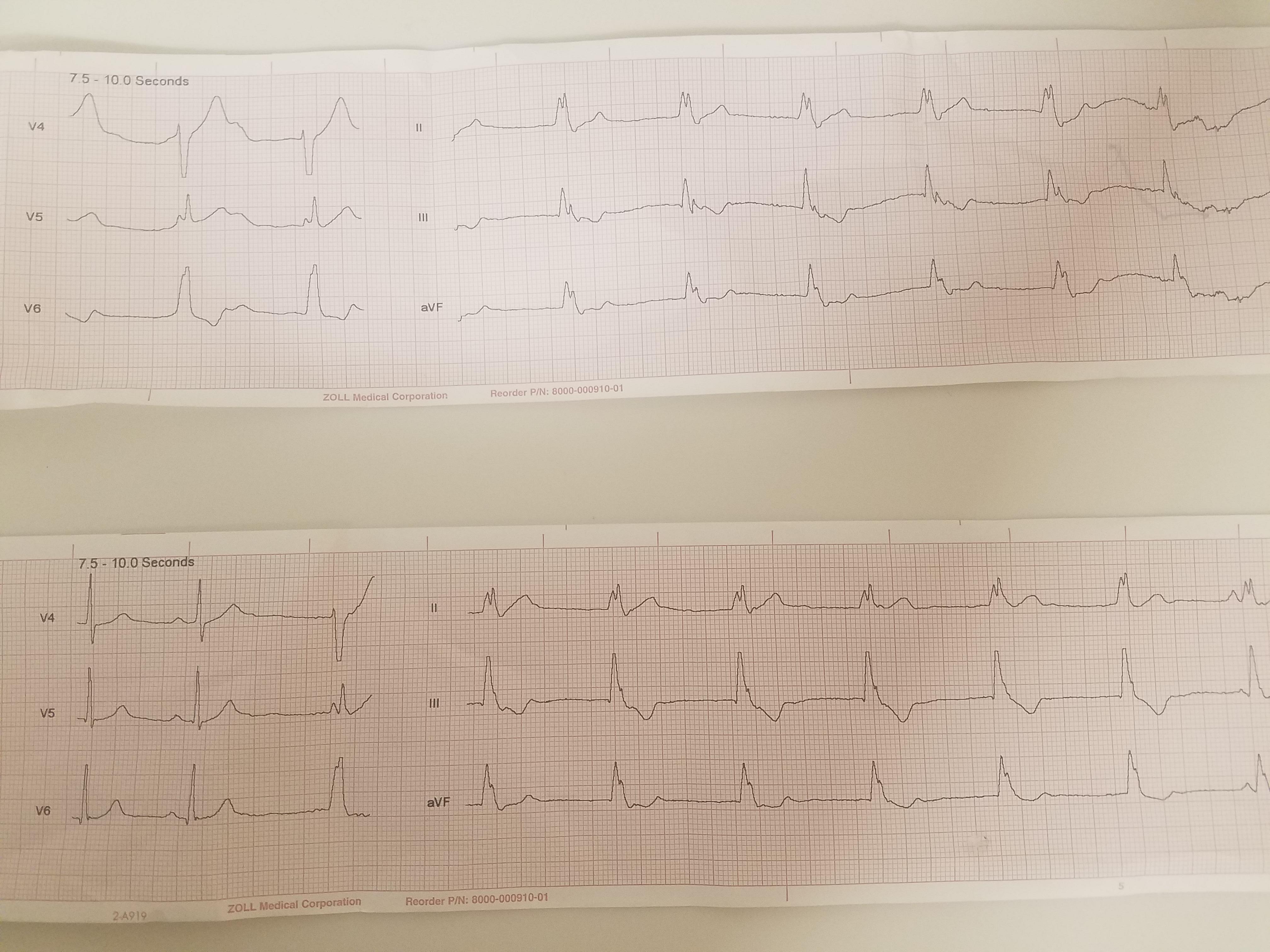EKG3.jpg