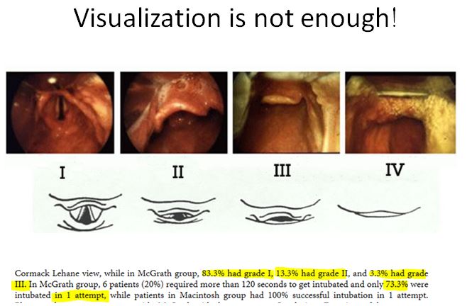 Visualization.JPG