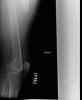 xray 2.jpg