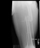 xrays.jpg