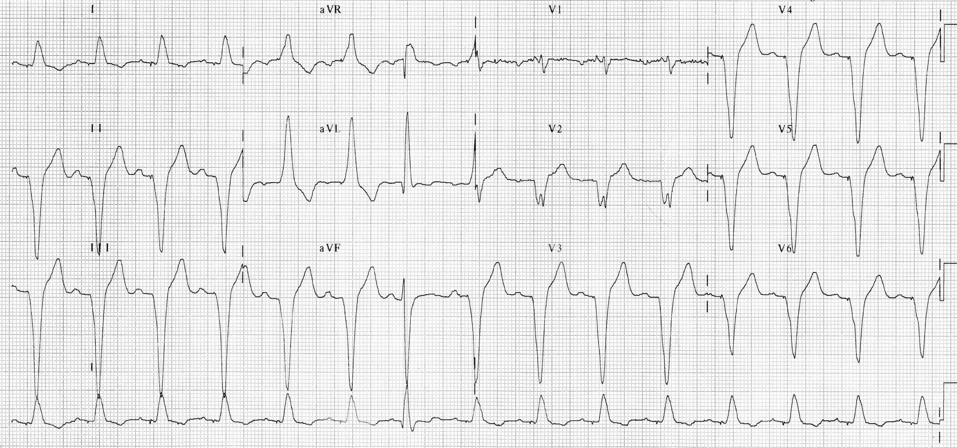 ekg_02.jpg