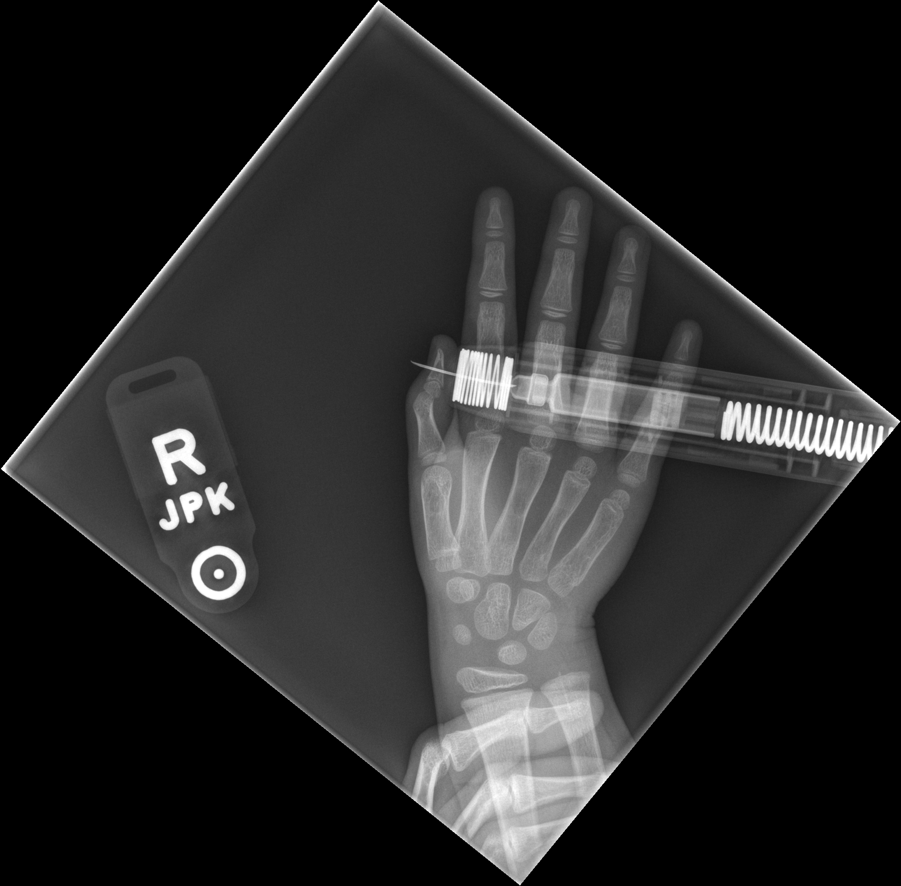 epipen-finger-1.jpg