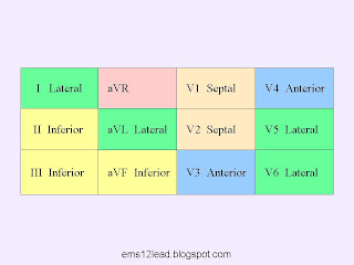 contiguous+leads.jpg