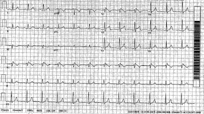 ECG.jpg