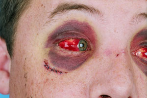 z-victim-11678.jpg